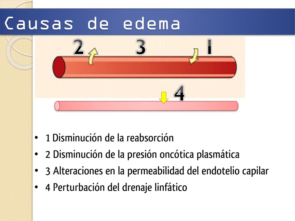 Náuseas debido a dolor de espalda